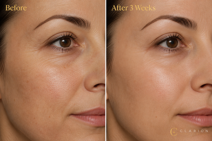 Clarion Deep Recovery Collagen Ampoule