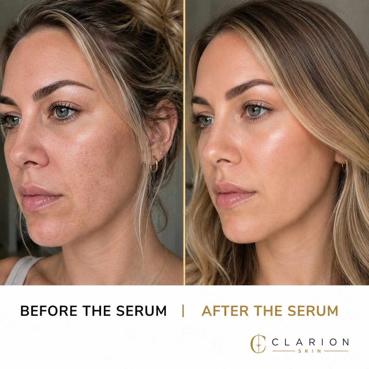 Clarion Recovery Serum