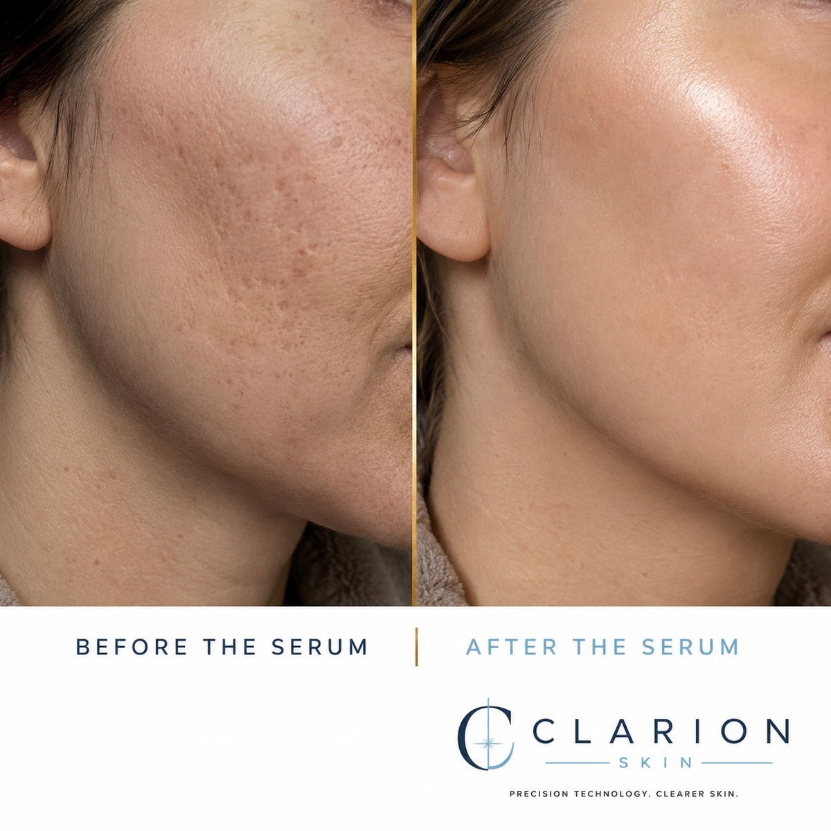 Clarion Recovery Serum