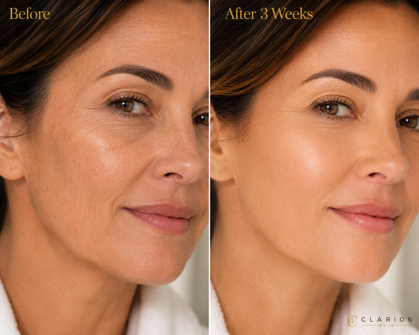 Clarion Deep Recovery Collagen Ampoule