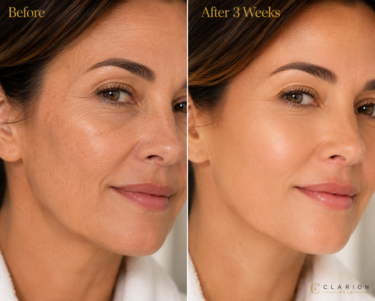Clear Ray Recovery Serum